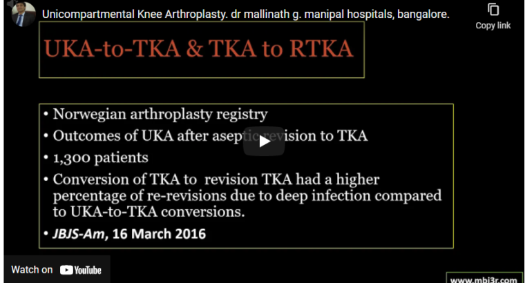 Uni-compartmental Knee Arthroplasty