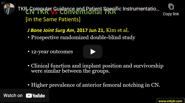 Computer Guidance and Patient-Specific Instrumentation in TKR