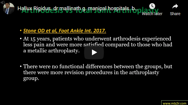 High Tibial Osteotomy