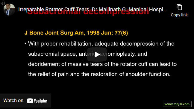 Irreparable Rotator Cuff Tears