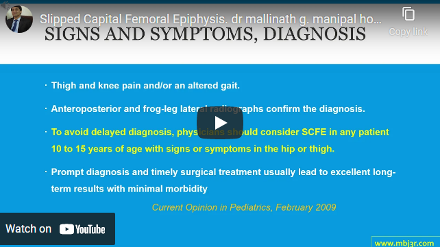 Slipped Capital Femoral Epiphysis