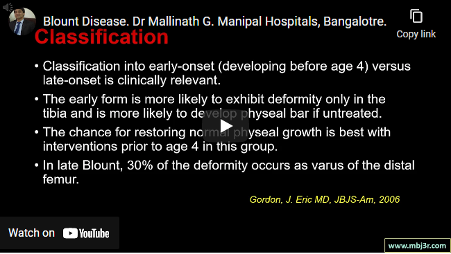 Blount Disease