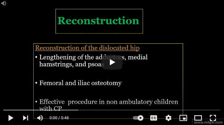 Hip Displacement in Cerebral Palsy