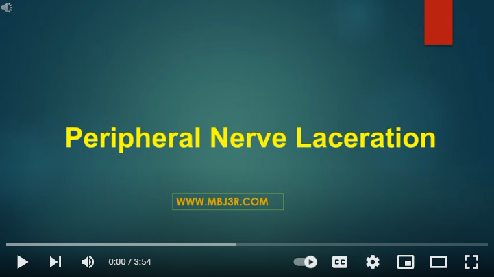 Peripheral Nerve Laceration